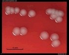 Escherichia coli